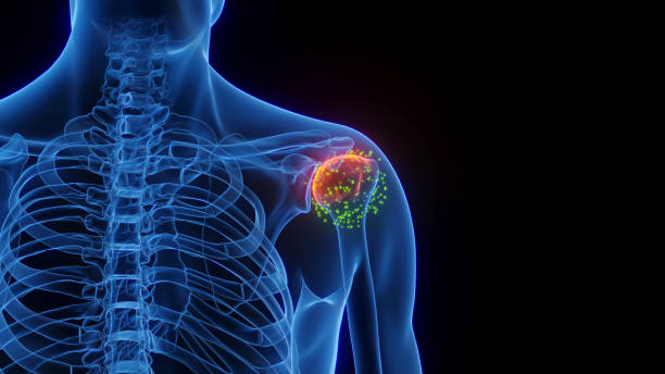 Síntomas más comunes