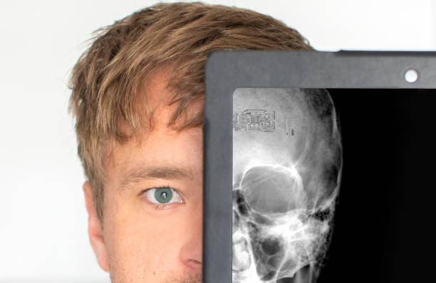 ¿Cómo funciona el tratamiento?