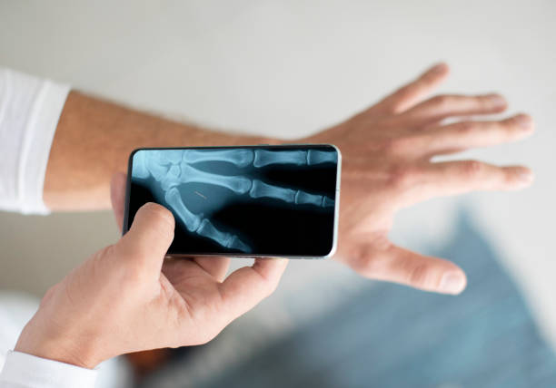 Beneficios de la radiofrecuencia médica