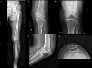 Pronóstico y calidad de vida